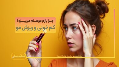 کم خونی و ریزش مو