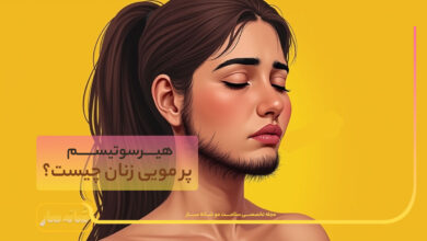 پرمویی در زنان