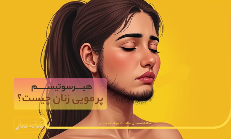 پرمویی در زنان