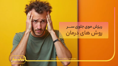 ریزش موی جلوی سر