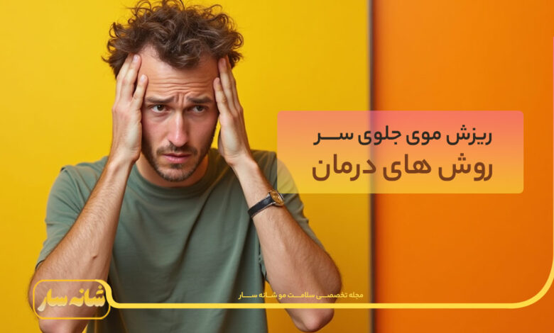 ریزش موی جلوی سر