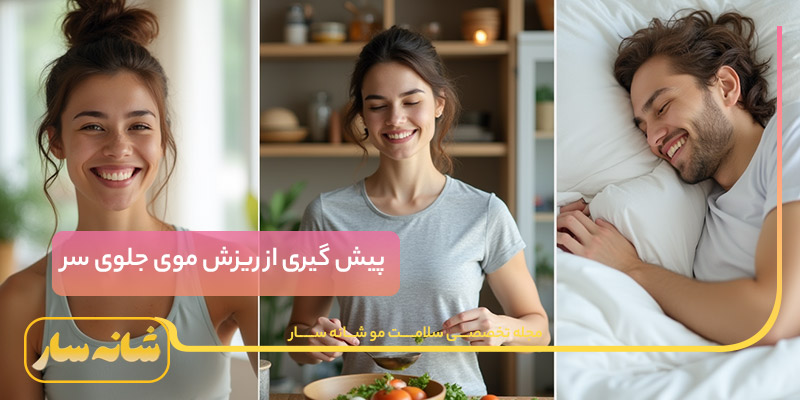 ریزش موی جلوی سر