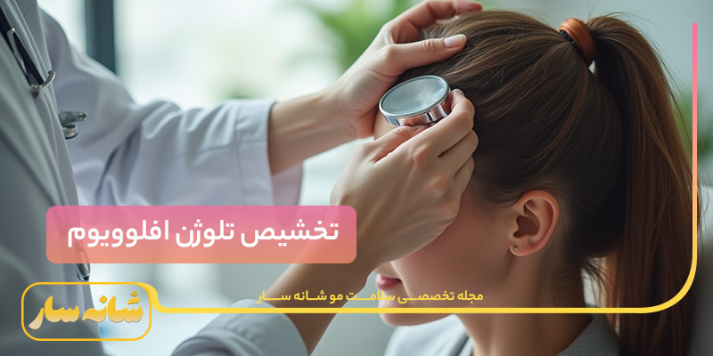 ریزش موی تلوژن افلوویوم