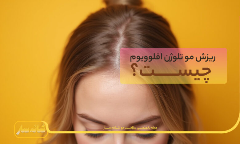 ریزش موی تلوژن افلوویوم