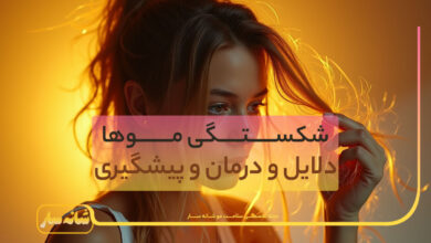 شکستگی مو
