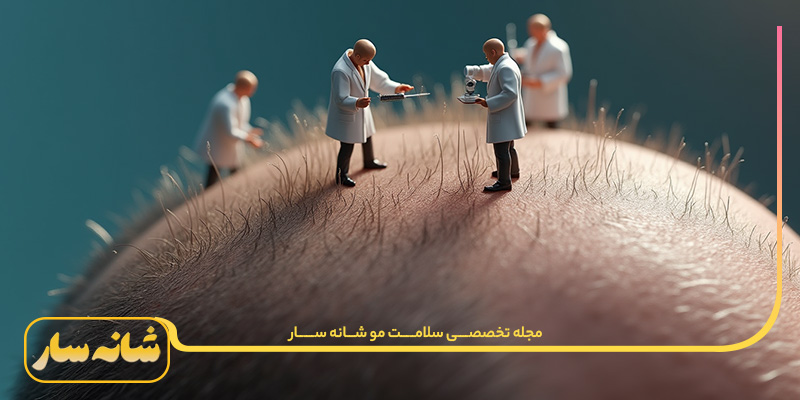 درمان ریزش موی شقیقه