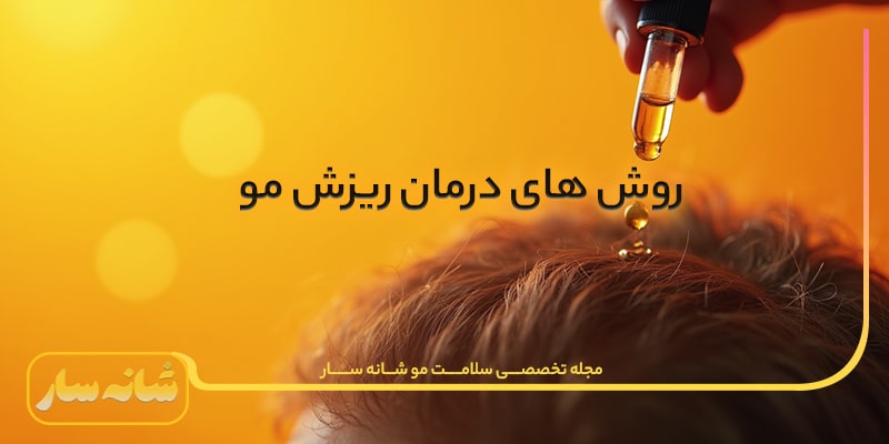 درمان ریزش مو در شانه سار