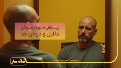 ریزش مو در مردان