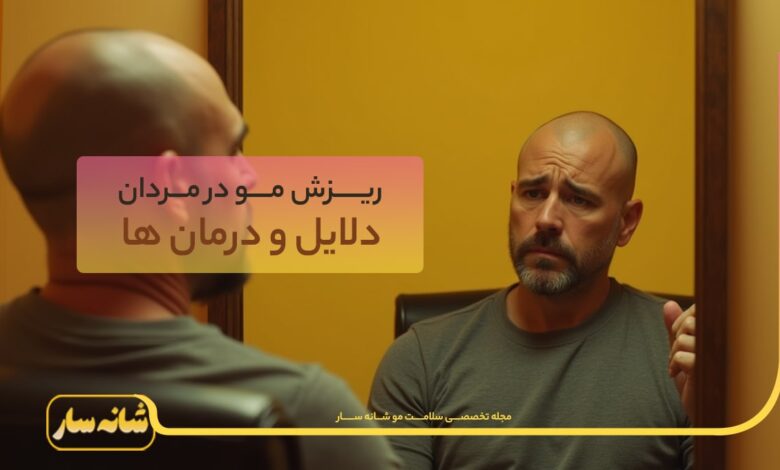 ریزش مو در مردان