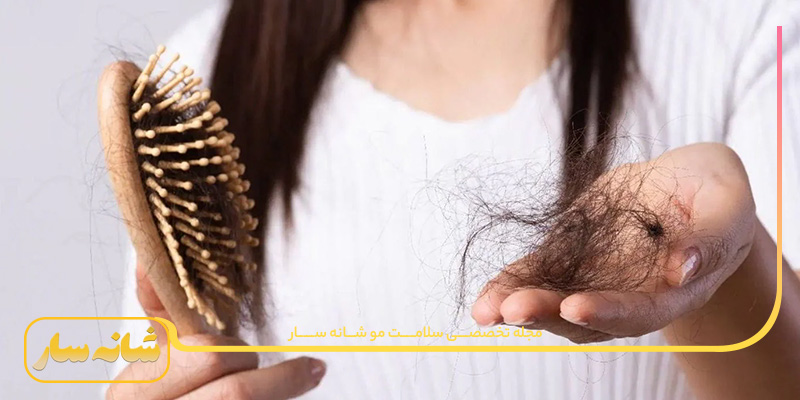 ریزش مو ناشی از سندروم تخمدان پلی کیستیک